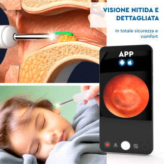 UdiGuard Otoscopio Pulizia Orecchie Rimozione Cerume Colore Bianco